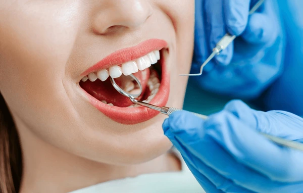 Root Canal Treatment